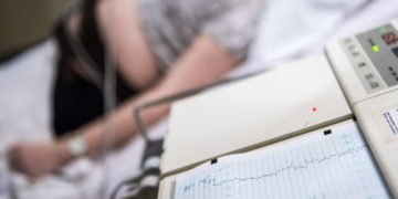 Das CTG als Vorsorgeuntersuchung in der Schwangerschaft