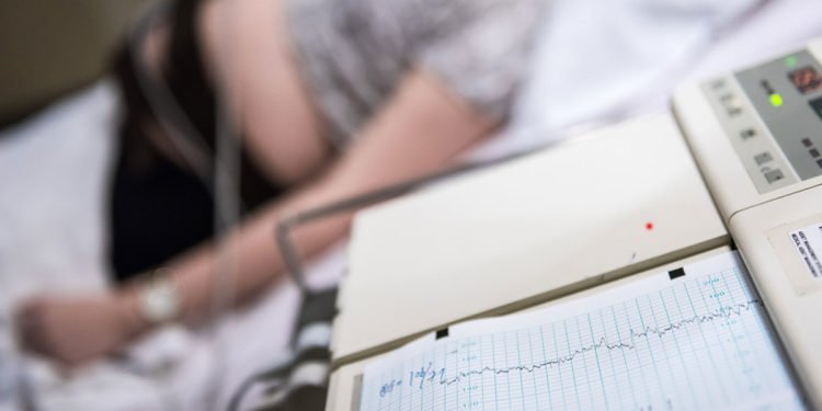 Das CTG als Vorsorgeuntersuchung in der Schwangerschaft