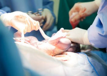 Die Nabelschnur auspulsieren lassen