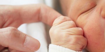 Gelbsucht bei Neugeborenen